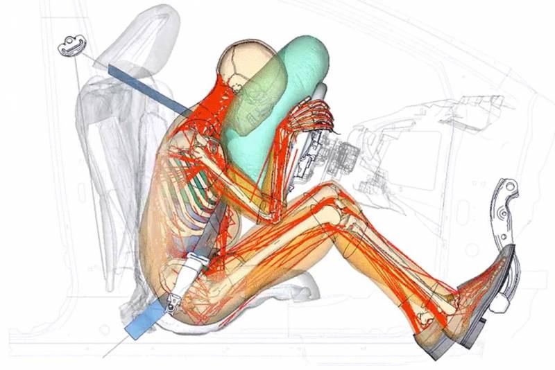 Diagram of human body experiencing a car accident.